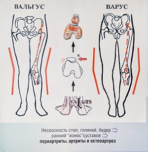 990A8424